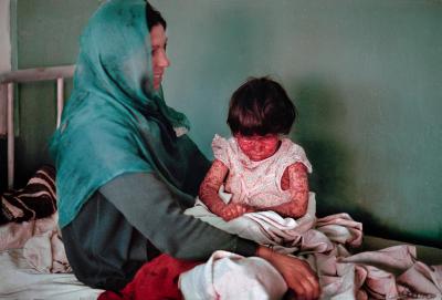 其他.史蒂夫·麦凯瑞SteveMcCurry下集Children of War 41的摄影作品