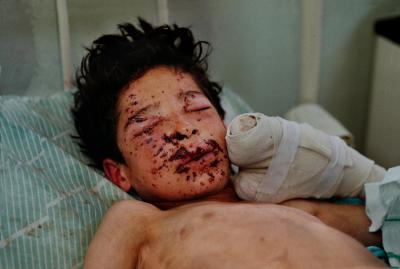 其他.史蒂夫·麦凯瑞SteveMcCurry下集Children of War 41的摄影作品