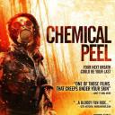 Chemical Peel