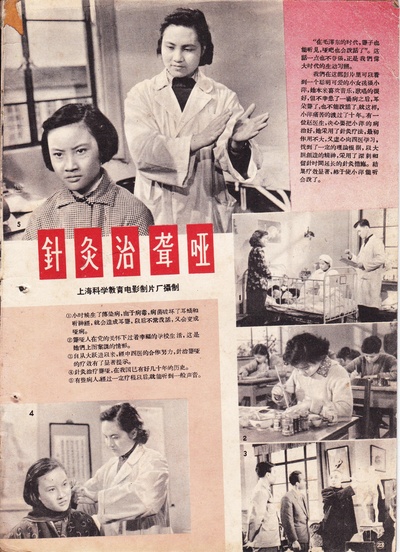针灸治聋哑的海报-正式海报